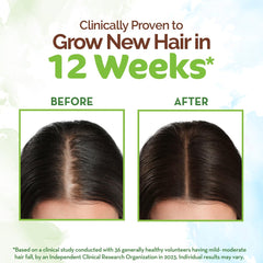 Mamaearth Rosemary Hair Growth Oil with Rosemary & Methi Dana for Promoting Hair Growth Mamaearth Rosemary Hair Growth Oil with Rosemary & Methi Dana for Promoting Hair Growth