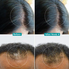 Pilgrim Cosmetics 3% Redensyl & 4% Anagain Advanced Hair Growth Serum 30ml
