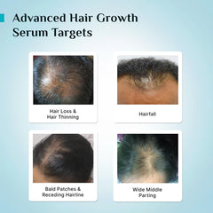 Pilgrim Cosmetics 3% Redensyl & 4% Anagain Advanced Hair Growth Serum 30ml